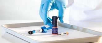 5 things you need to know about adhesives in dentistry