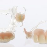 Ацеталовый зубной протез