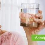 аллергия на зубные протезы