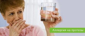 аллергия на зубные протезы