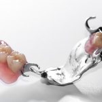 Базис – каркас для зубного протеза