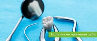 pain after tooth extraction