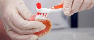 Чем чистить зубные протезы