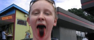 black coating on a child&#39;s tongue