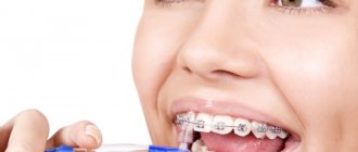 Cleaning braces with a brush