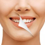 What you need to know about dental restoration