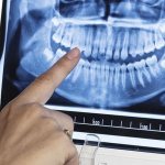 Что показывает ортопантомограмма зубов?