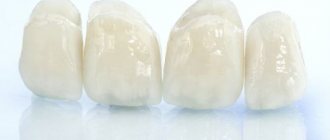 Zirconium dental prosthesis