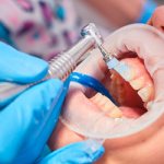 Dentist performs professional hygiene - Dentistry Line Smile