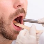 Диагностика рака губы