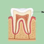 Tooth enamel in pictures