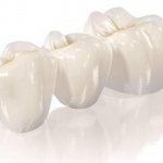 Формы жевательных зубов