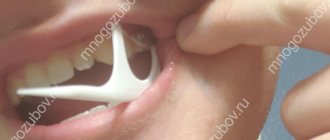Photo: floss stuck between teeth