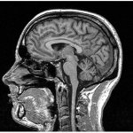 Фото МРТ головного мозга