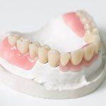 Photo of a plastic denture