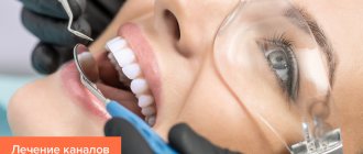 Фото процесса лечения каналов зуба