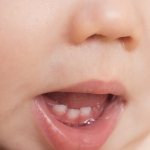 Photo of baby teeth erupting