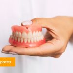 Photo of a removable denture