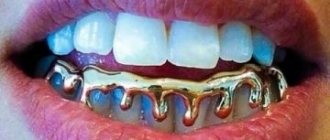 фото установленных грилзы на зубы