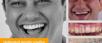 Photo of patient&#39;s teeth before and after digital smile design