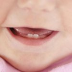 Gel for children&#39;s gums