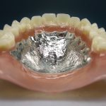 Границы базиса съемного пластиночного зубного протеза
