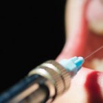 инъекция обезболивающего при лечении зуба