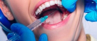 Инфильтрационная анестезия при лечении зубов