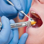 infiltration anesthesia in dentistry