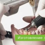 изготовление зубных протезов