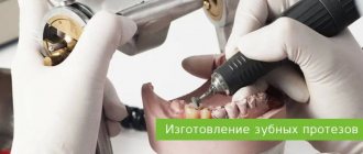 production of dentures