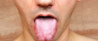 How to determine the causes of teeth marks on the sides of the tongue, and whether you should worry about it