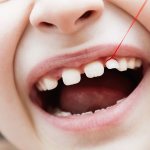 How to distinguish a baby tooth from a molar