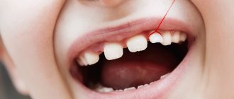 How to distinguish a baby tooth from a molar