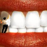 how to use global white teeth whitening gel