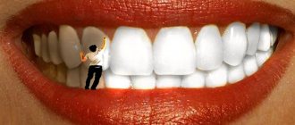 как пользоваться отбеливающим гелем для зубов global white