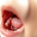 Как помочь ребенку при появлении первых молочных зубов