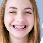 Как правильно чистить зубы с брекетами?
