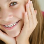 What braces should I install for my child?