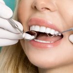 what types of fillings are there