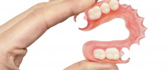 Which dentures are better?