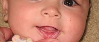 Candidiasis in a child&#39;s mouth
