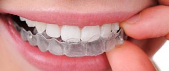 picture of teeth whitening tray