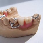 Adams, Roach and other types of clasps: classification, manufacture and installation
