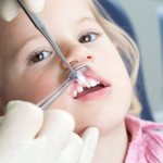 When is tooth extraction necessary?