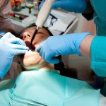 When is tooth extraction with a cyst indicated?