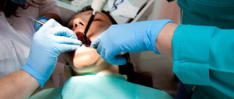 When is tooth extraction with a cyst indicated?