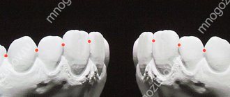 contact area between teeth