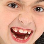 Molars in children