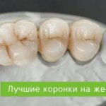 crowns for chewing teeth
